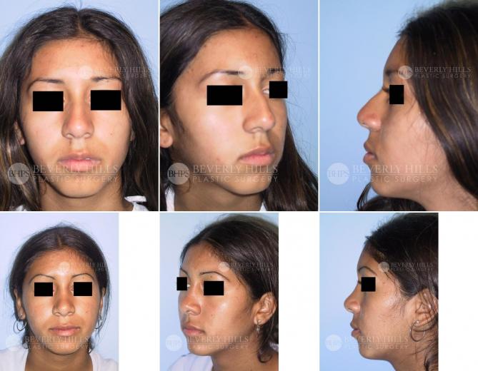 Beverly Hills Plastic Surgery gallery image 385