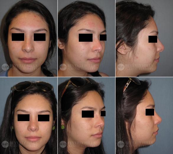 Beverly Hills Plastic Surgery gallery image 386