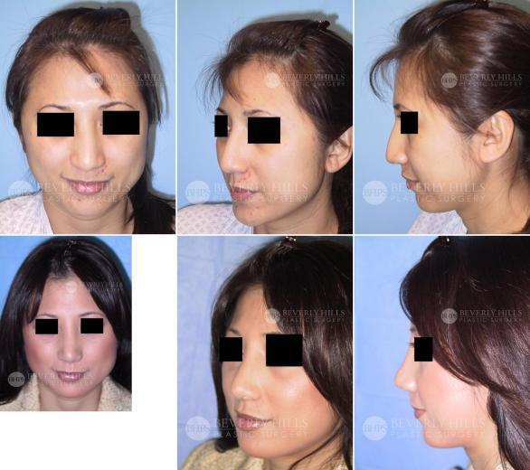 Beverly Hills Plastic Surgery gallery image 387