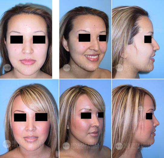 Beverly Hills Plastic Surgery gallery image 391