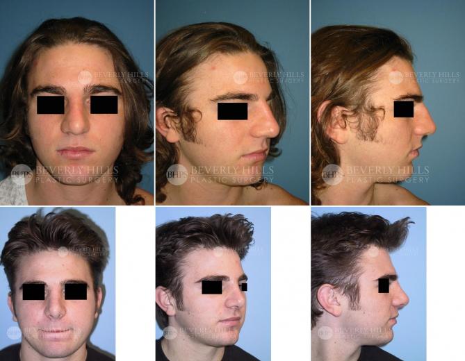 Beverly Hills Plastic Surgery gallery image 392