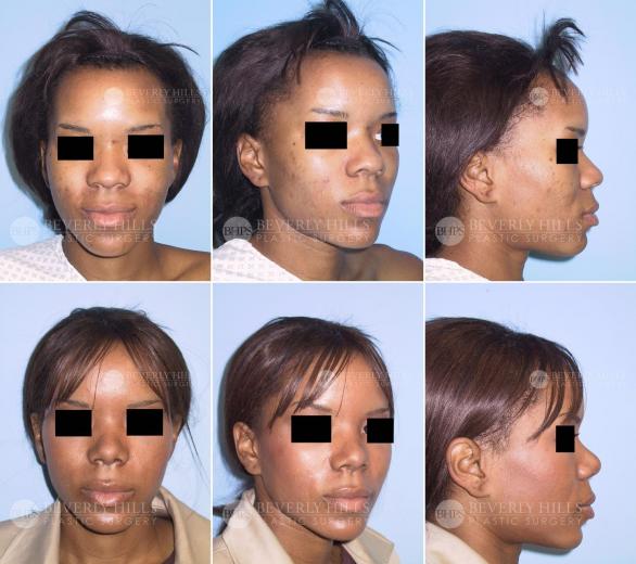 Beverly Hills Plastic Surgery gallery image 395