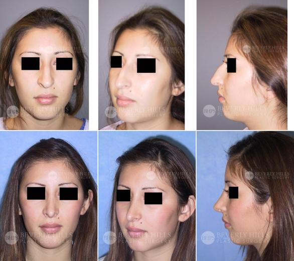 Beverly Hills Plastic Surgery gallery image 399