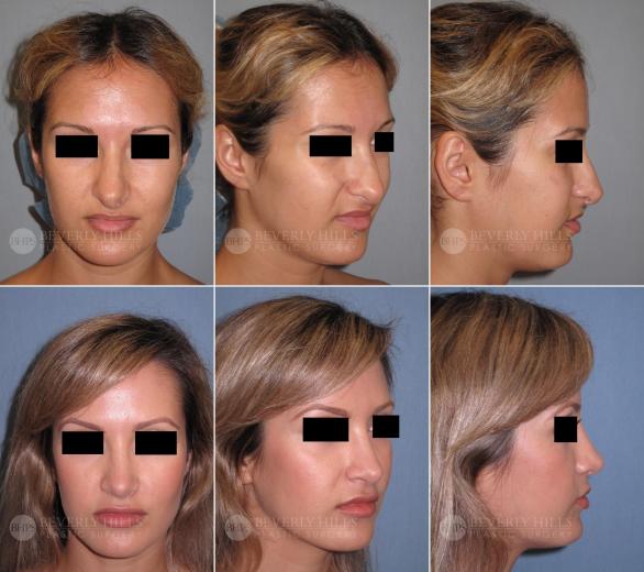 Beverly Hills Plastic Surgery gallery image 400