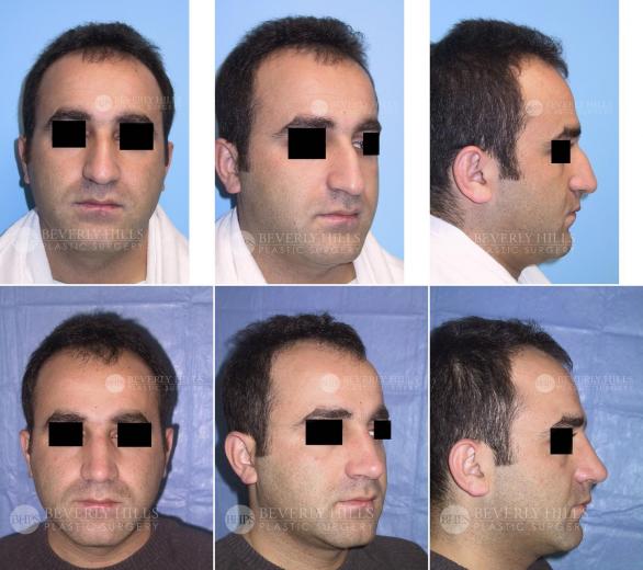 Beverly Hills Plastic Surgery gallery image 402