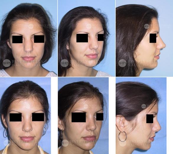 Beverly Hills Plastic Surgery gallery image 403