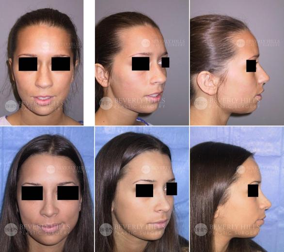 Beverly Hills Plastic Surgery gallery image 405
