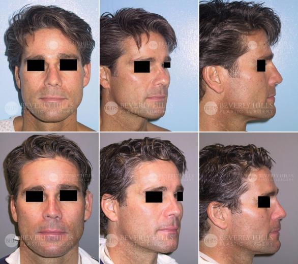Beverly Hills Plastic Surgery gallery image 412