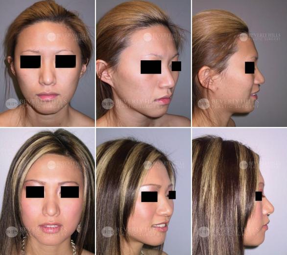 Beverly Hills Plastic Surgery gallery image 417