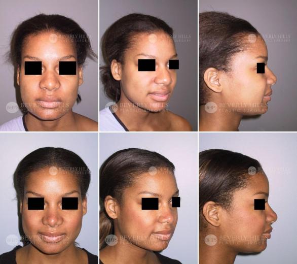 Beverly Hills Plastic Surgery gallery image 420