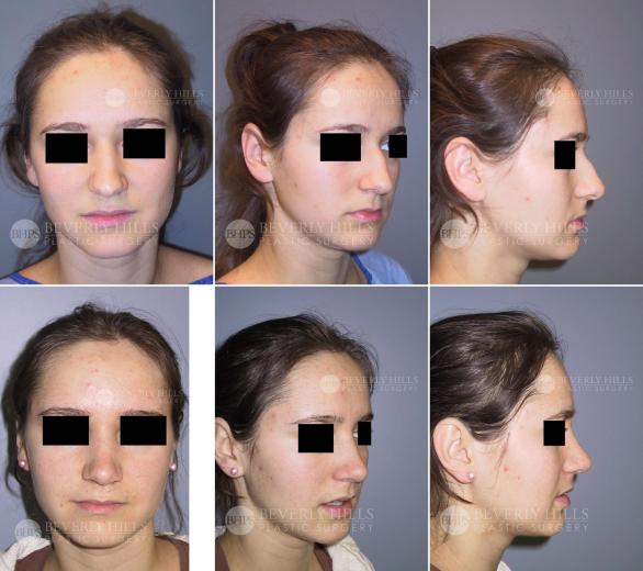 Beverly Hills Plastic Surgery gallery image 421