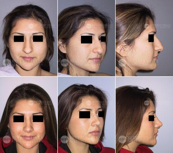 Beverly Hills Plastic Surgery gallery image 422
