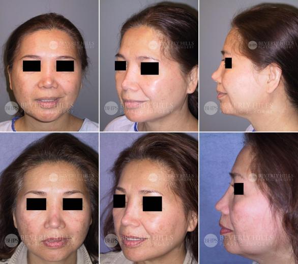 Beverly Hills Plastic Surgery gallery image 423