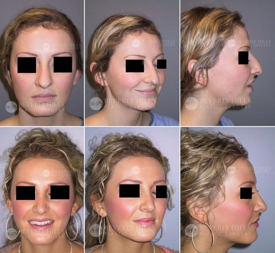Beverly Hills Plastic Surgery gallery image 425