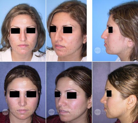Beverly Hills Plastic Surgery gallery image 428