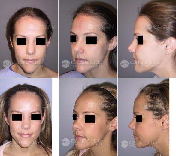 Beverly Hills Plastic Surgery gallery image 433