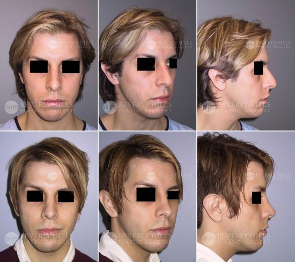Beverly Hills Plastic Surgery gallery image 440