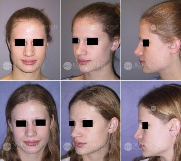 Beverly Hills Plastic Surgery gallery image 446