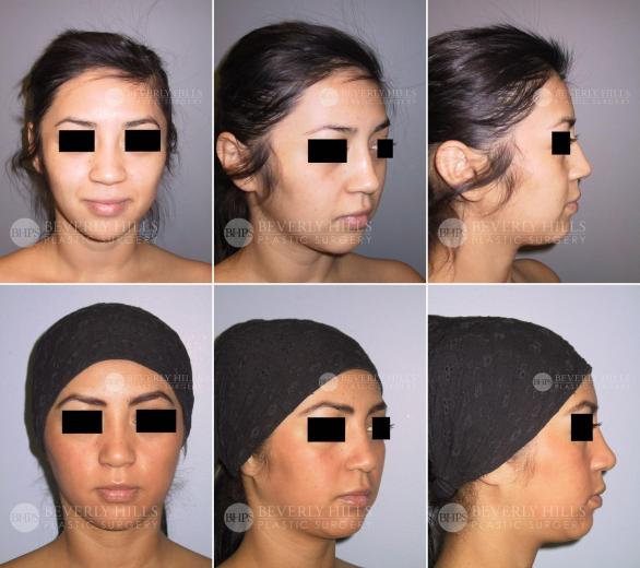 Beverly Hills Plastic Surgery gallery image 448