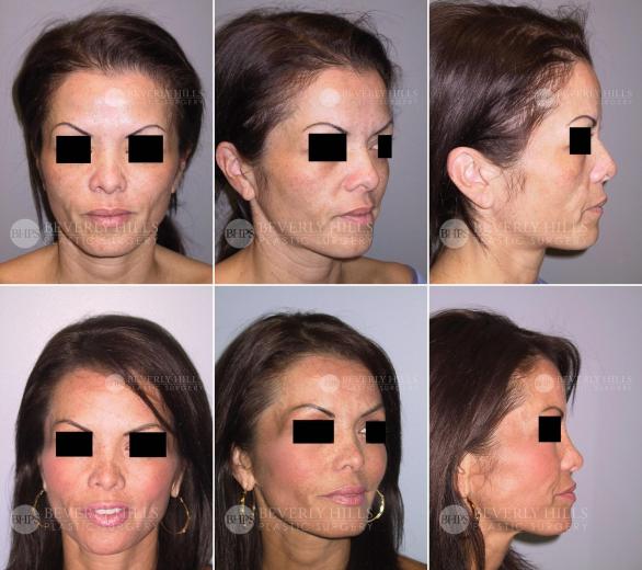 Beverly Hills Plastic Surgery gallery image 449