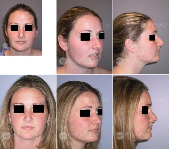 Beverly Hills Plastic Surgery gallery image 450