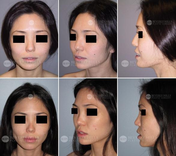 Beverly Hills Plastic Surgery gallery image 451