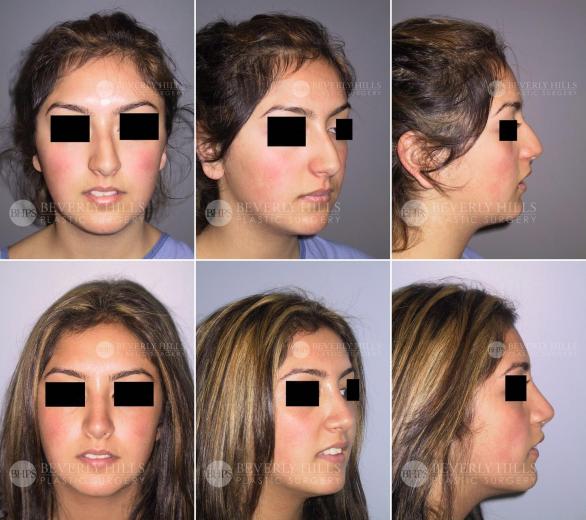 Beverly Hills Plastic Surgery gallery image 453