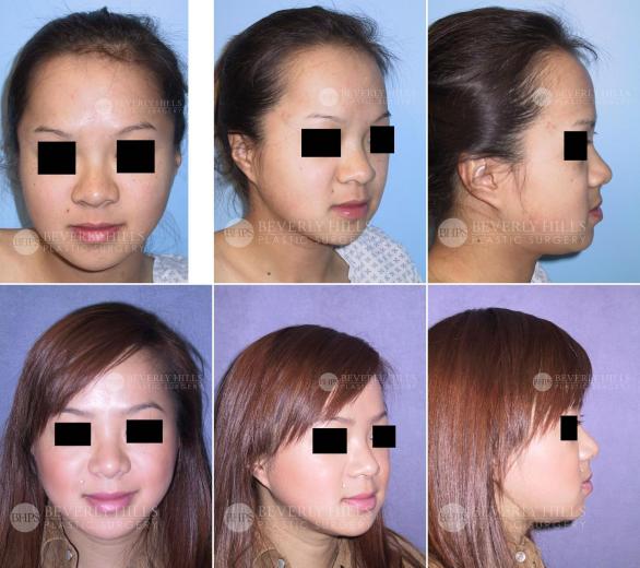 Beverly Hills Plastic Surgery gallery image 454