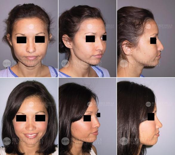 Beverly Hills Plastic Surgery gallery image 455