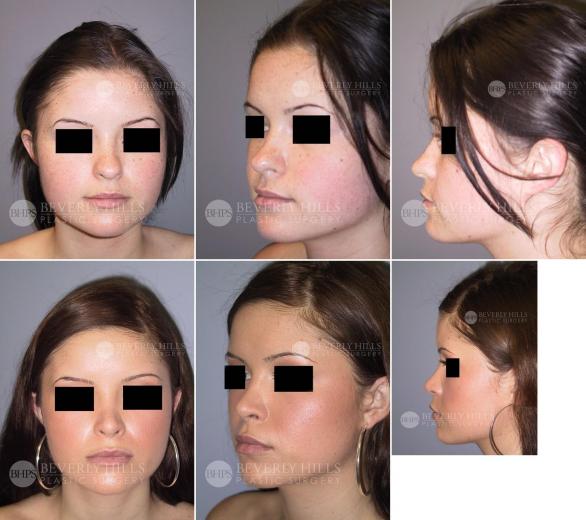 Beverly Hills Plastic Surgery gallery image 459