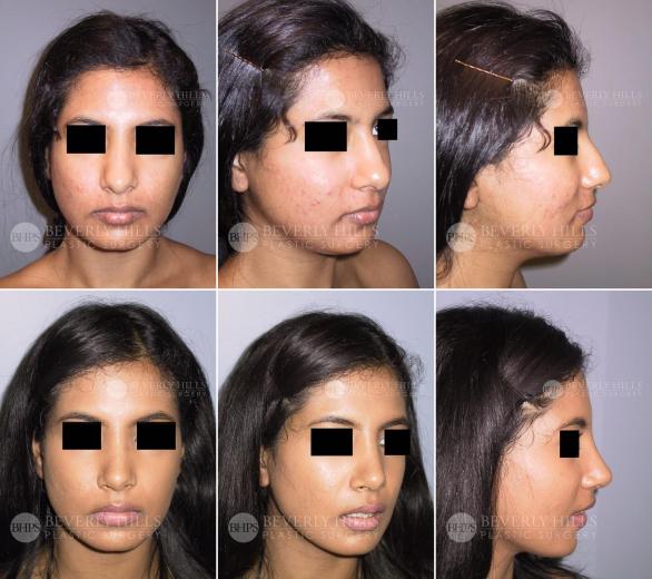 Beverly Hills Plastic Surgery gallery image 460