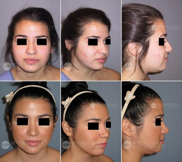 Beverly Hills Plastic Surgery gallery image 462