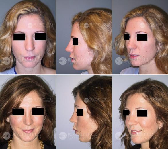 Beverly Hills Plastic Surgery gallery image 463