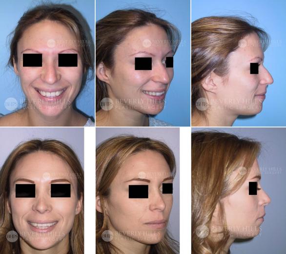 Beverly Hills Plastic Surgery gallery image 464