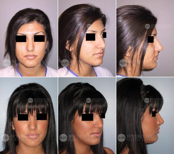 Beverly Hills Plastic Surgery gallery image 465