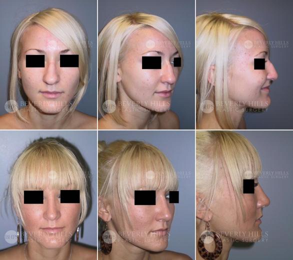 Beverly Hills Plastic Surgery gallery image 467