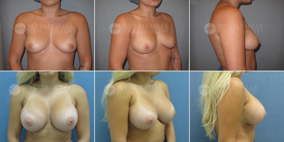 Beverly Hills Plastic Surgery gallery image 468