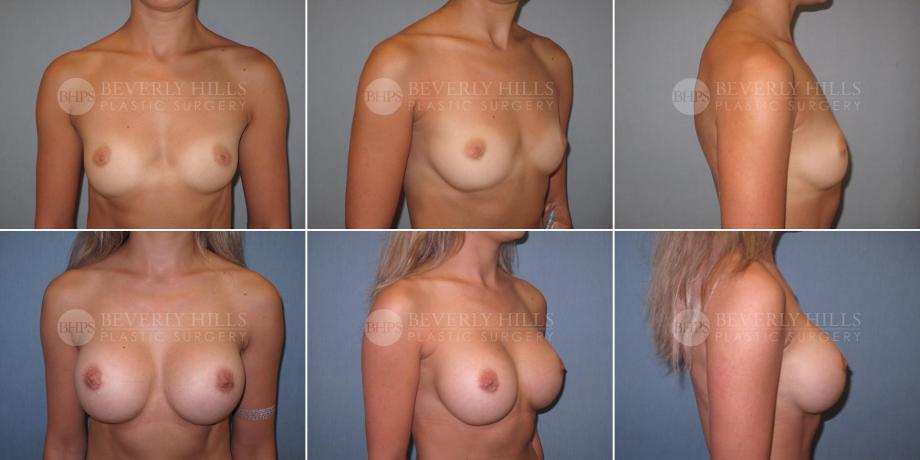Beverly Hills Plastic Surgery gallery image 469