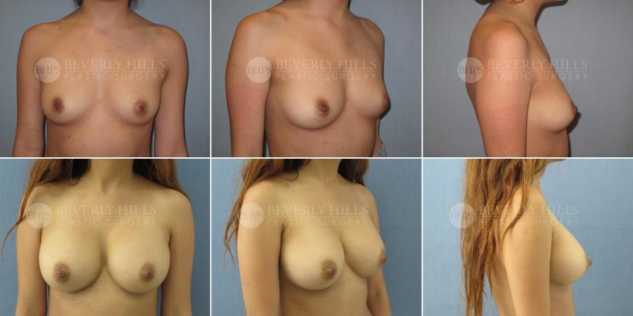 Beverly Hills Plastic Surgery gallery image 471