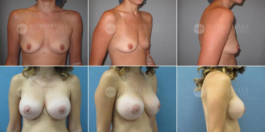 Beverly Hills Plastic Surgery gallery image 472