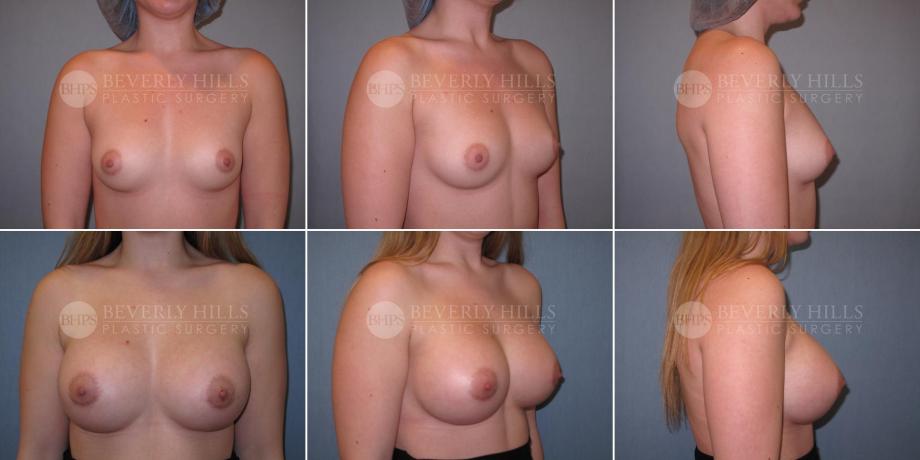 Beverly Hills Plastic Surgery gallery image 477
