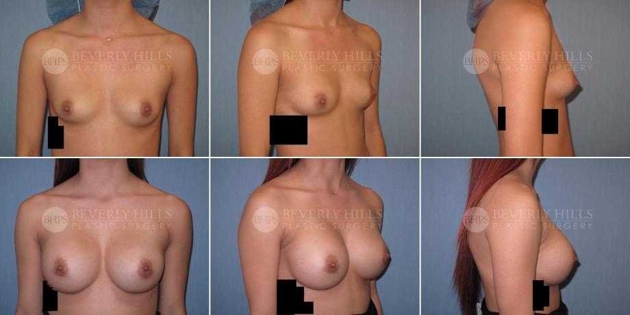 Beverly Hills Plastic Surgery gallery image 478