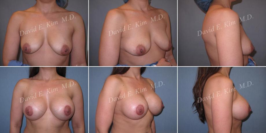 Beverly Hills Plastic Surgery gallery image 481