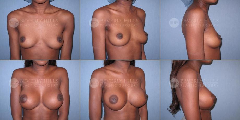 Beverly Hills Plastic Surgery gallery image 482
