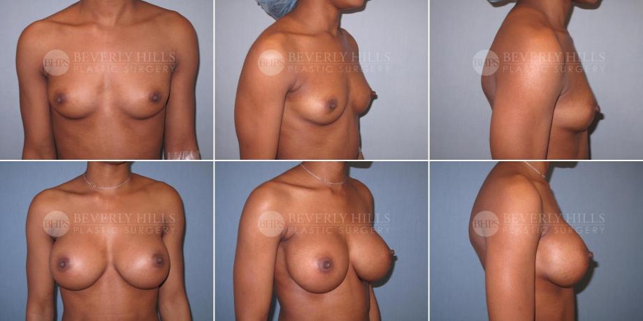 Beverly Hills Plastic Surgery gallery image 483