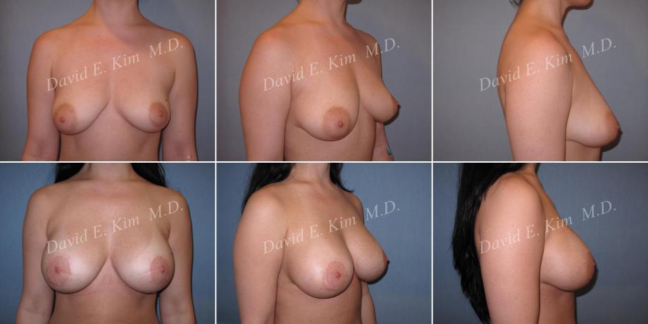 Beverly Hills Plastic Surgery gallery image 484