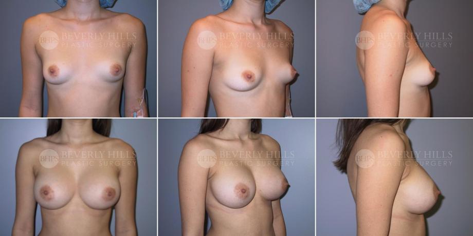Beverly Hills Plastic Surgery gallery image 488
