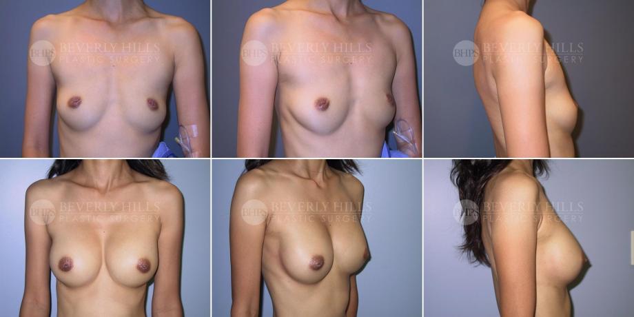 Beverly Hills Plastic Surgery gallery image 489