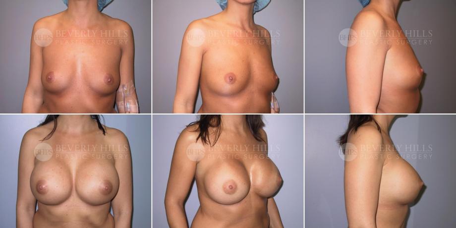 Beverly Hills Plastic Surgery gallery image 490