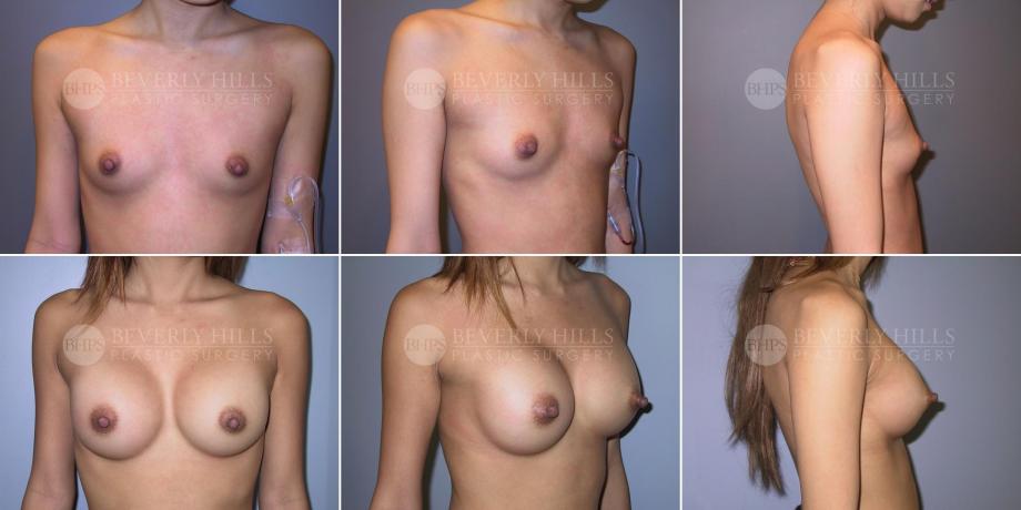 Beverly Hills Plastic Surgery gallery image 491